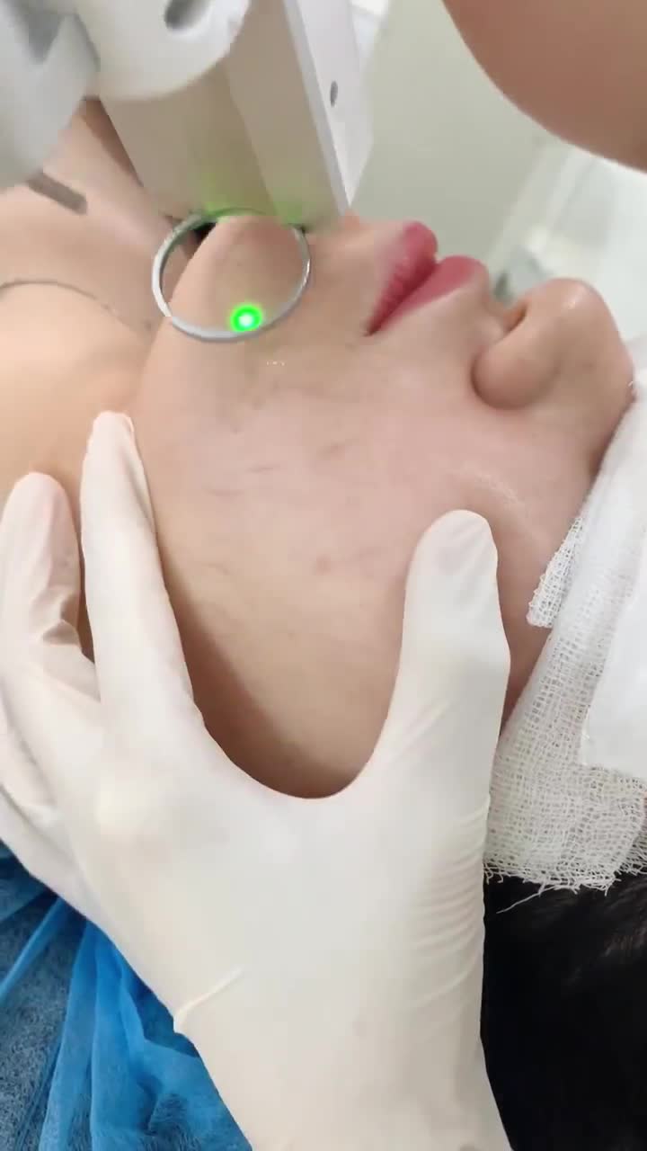 Trị giãn mao mạch, hiệu quả ngay từ buổi đầu tiên