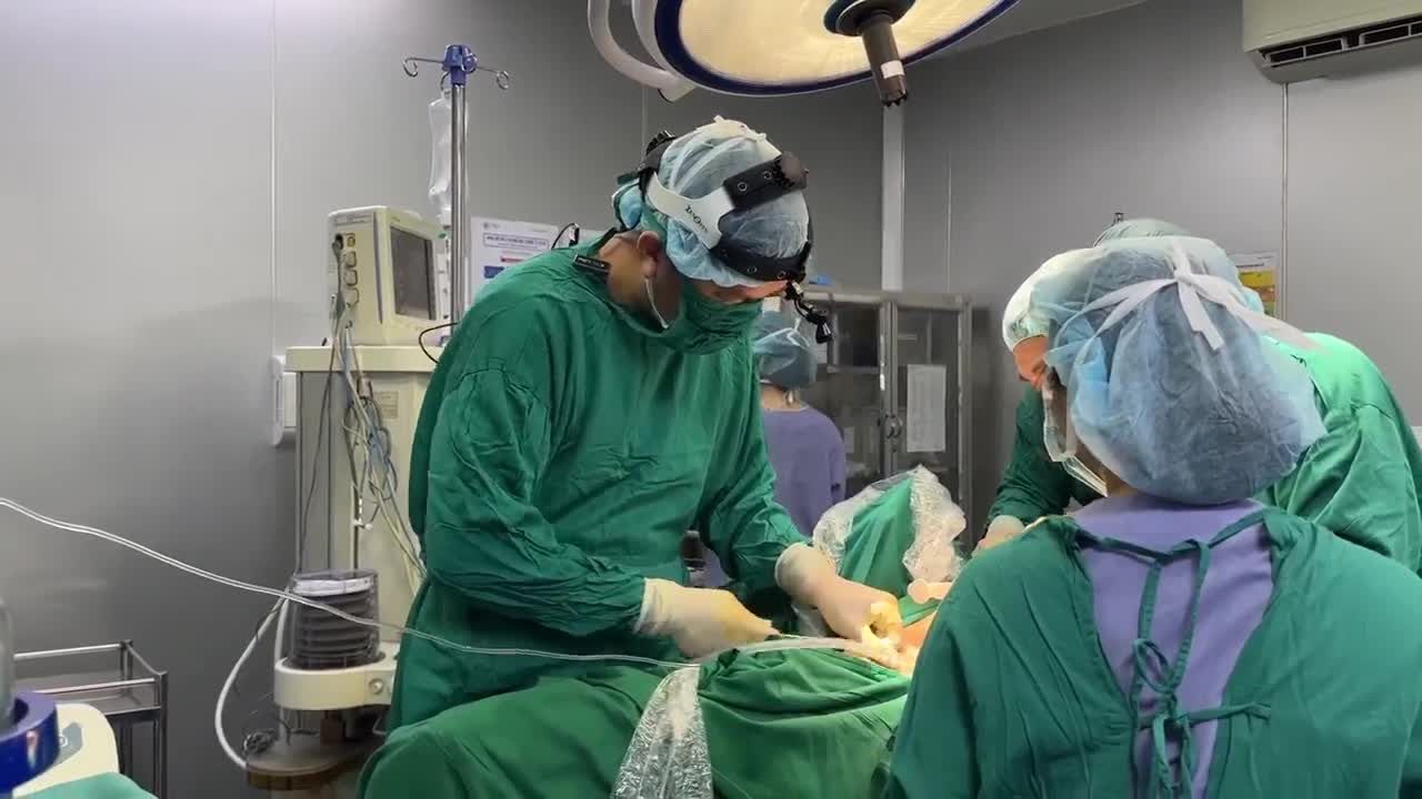 Khách hàng nâng V1 kết hợp hút tuyến mồ hôi nách.