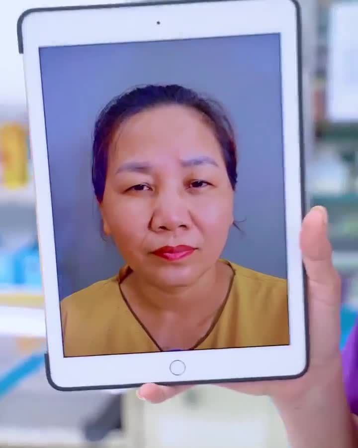 Trẻ ra 10 tuổi nhờ nâng cung mày bạn có tin Theo dõi ngay