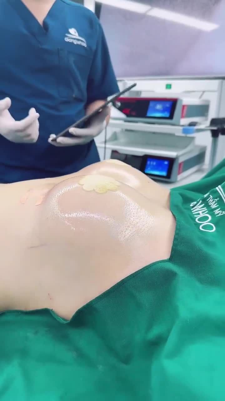 Chị N - Thủ Đức, từng sở hữu vòng 1 khiêm tốn, phía trên thì lộ rõ xương ức, khiến chị cảm thấy rất tự ti khi đi chơi và đi tiệc cùng bạn bè.