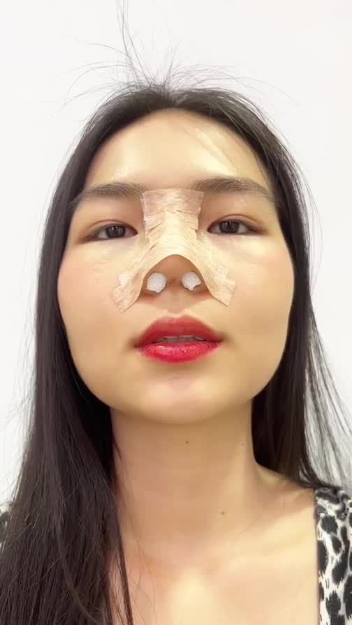 TRẦM TRỒ với NÉT ĐẸP lai tây của Nữ sinh GenZ khi thực hiện Nâng mũi Sline 3D tại JW