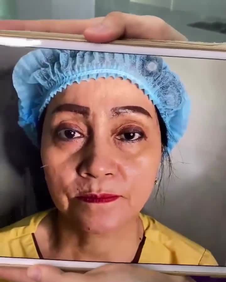 Khách hàng khu vực phía nam nếu mí mắt lỗi hỏng đừng vội lo lắng đến ngay Dr.Hải Lê Sài Gòn để có giải pháp bạn nhé