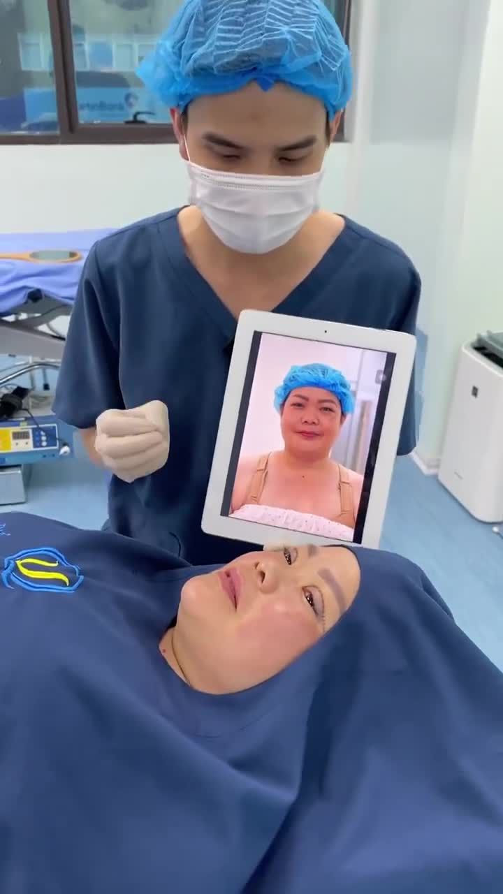 Kết quả Cắt mí cho K.H đã Thu ng.ực phì đại + Treo sa trễ ngày hôm qua.