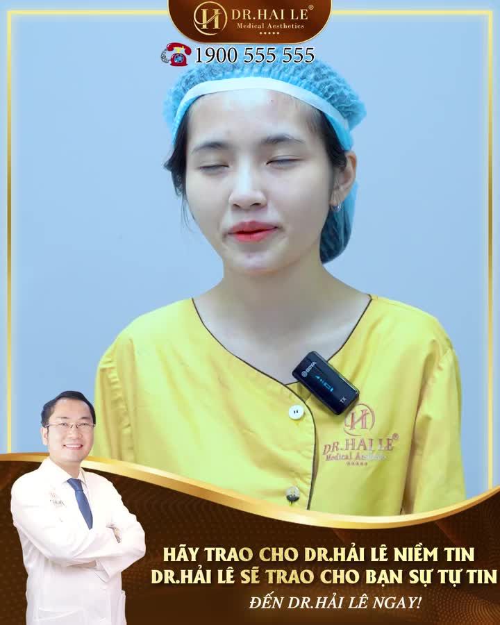 Nâng mũi Dr.Hải Lê- Đánh bay sự tự ti về MŨI TẸT- ĐẦU MŨI TO chỉ sau 60 phút!