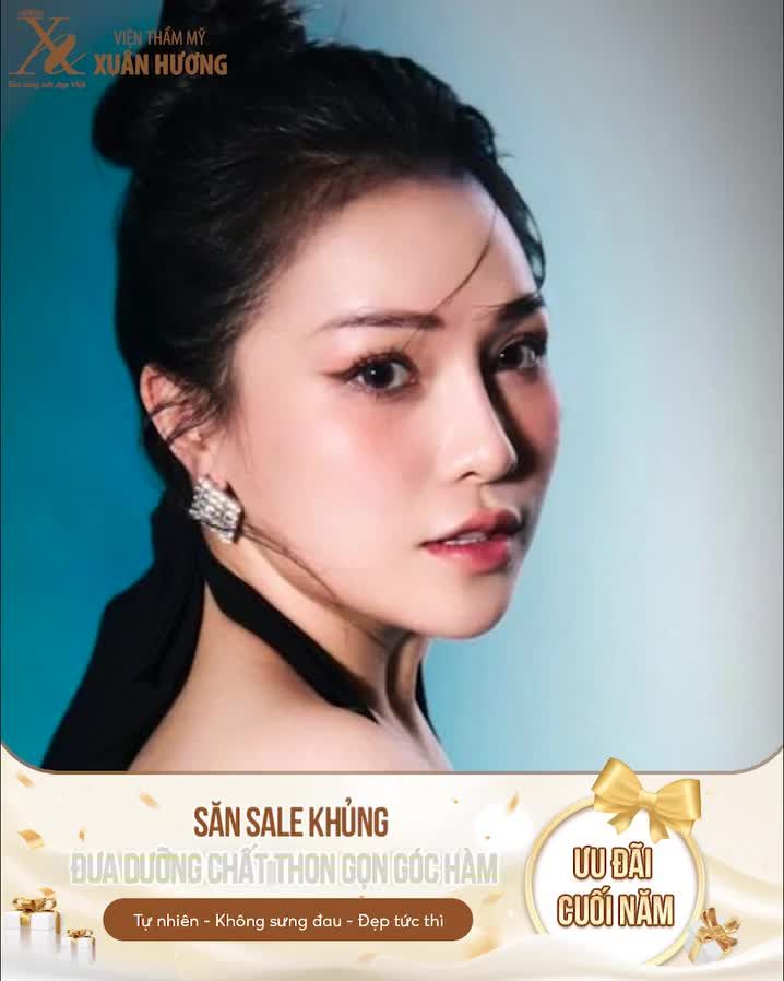 Khi hàm bạnh to không cân xứng khiến gương mặt thô, to bè và kém xinh