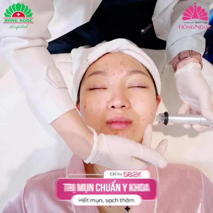 DỨT ĐIỂM MỤN CHỈ SAU 1 LIỆU TRÌNH