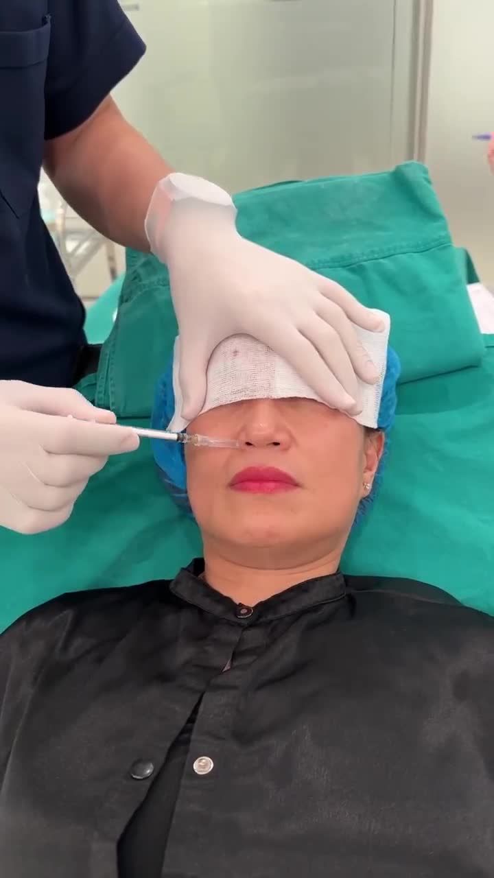 PHÂN TÍCH TÌNH TRẠNG RÃNH MŨI MÁ SÂU