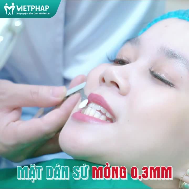 DÁN SỨ VENEER - RĂNG ĐẸP KHÔNG CẦN MÀI