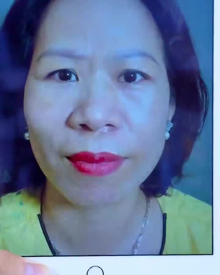 Nâng cung mày, giải pháp vàng giúp khách hàng trông trẻ trung rạng rỡ như thế nào?
