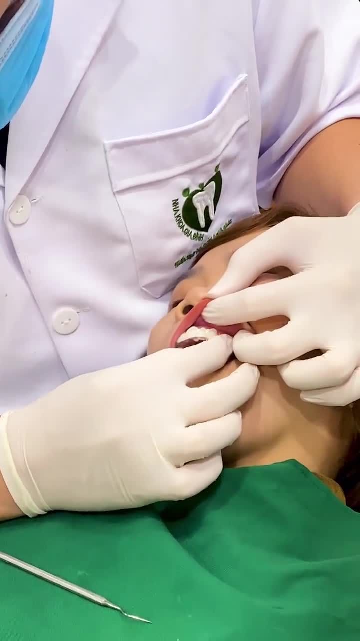 QUÁ TRÌNH THẨM MỸ 18 ĐƠN VỊ RĂNG SỨ CHO CHỊ KHÁCH ĐẾN TỪ NINH BÌNH