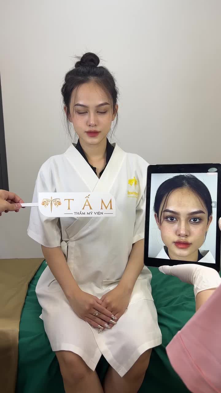 Ca Vline Perfect quay lại tái khám tại TMV Tấm