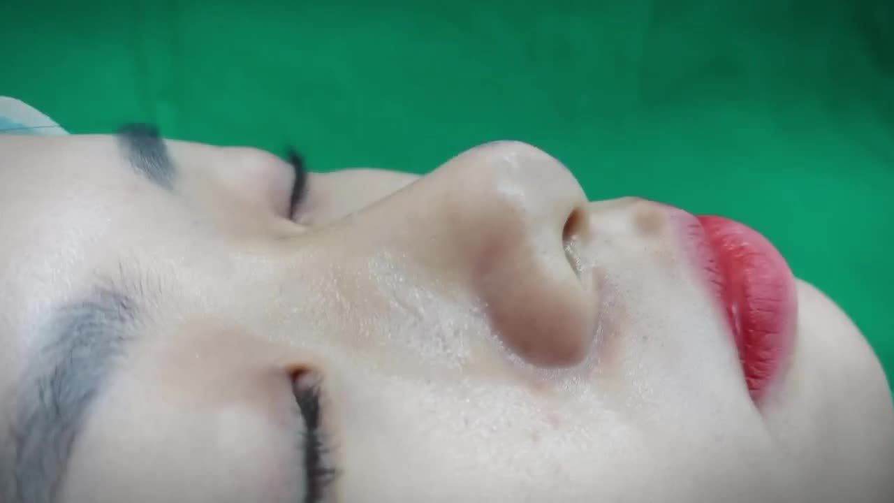 Kết quả nâng mũi sau 60p sẽ như thế nào?