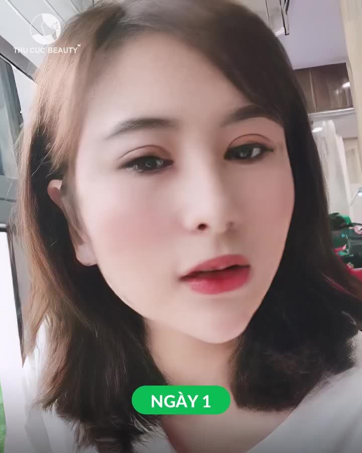 Mắt TC đã thay đổi như thế nào?