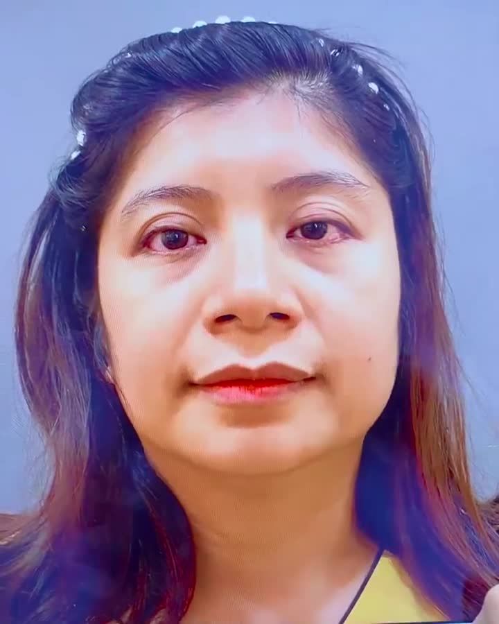 Khi mí lỗi hỏng được Dr.Hải Lê chỉnh hình Sẽ thành công như thế nào? Cả nhà cùng theo dõi