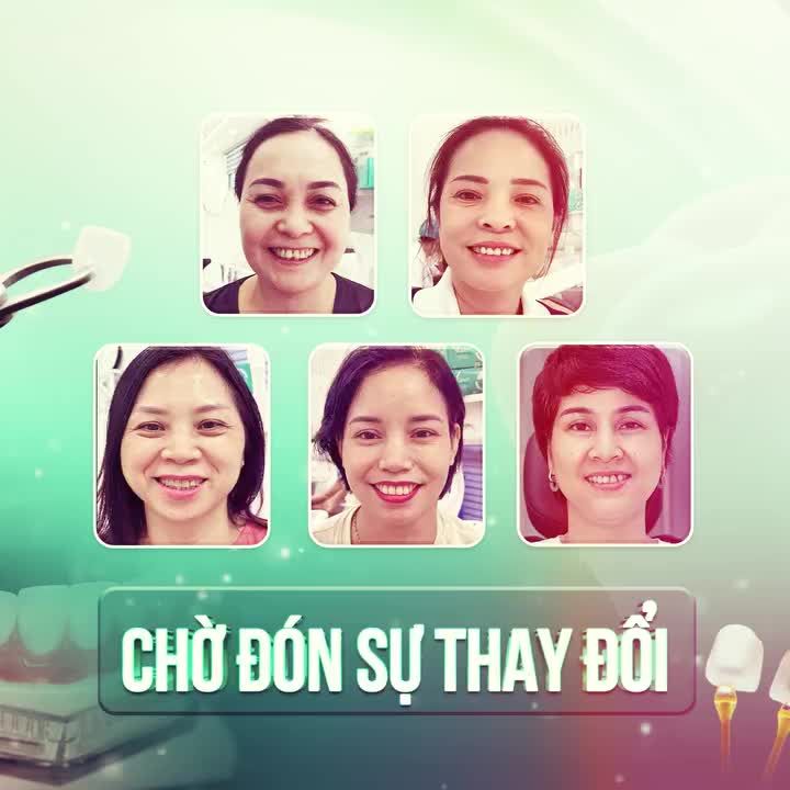 5 KHÁCH HÀNG SẼ THAY ĐỔI NHƯ THẾ NÀO KHI THẨM MỸ RĂNG TẠI NHA KHOA GIA ĐÌNH???