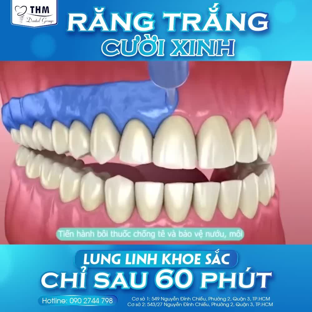 RĂNG TRẮNG CƯỜI XINH - LUNG LINH KHOE SẮC CHỈ SAU 60 PHÚT