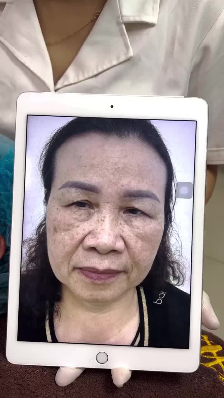Da sáng láng mịn, kịp đón Tết
