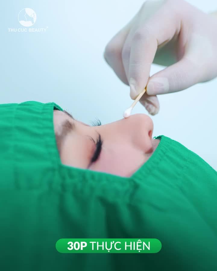 Chỉ 30P sở hữu dáng mũi cao sang cùng HHVN Thanh Thủy Không đau. Không sẹo. Không lộ sụn Bác sĩ trên 10 năm kinh nghiệm trực tiếp thực hiện