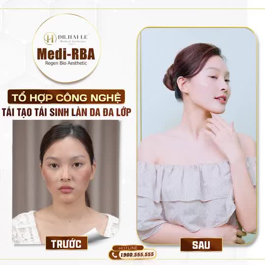 Mỗi vị khách hàng khi đến Dr.Hải Lê đều gặp phải những vấn đề về da khác nhau: khuyết điểm dày đặc, mụn thâm chi chít, lỗ chân lông to, nám và tàn nhang không phải là ngoại lệ.