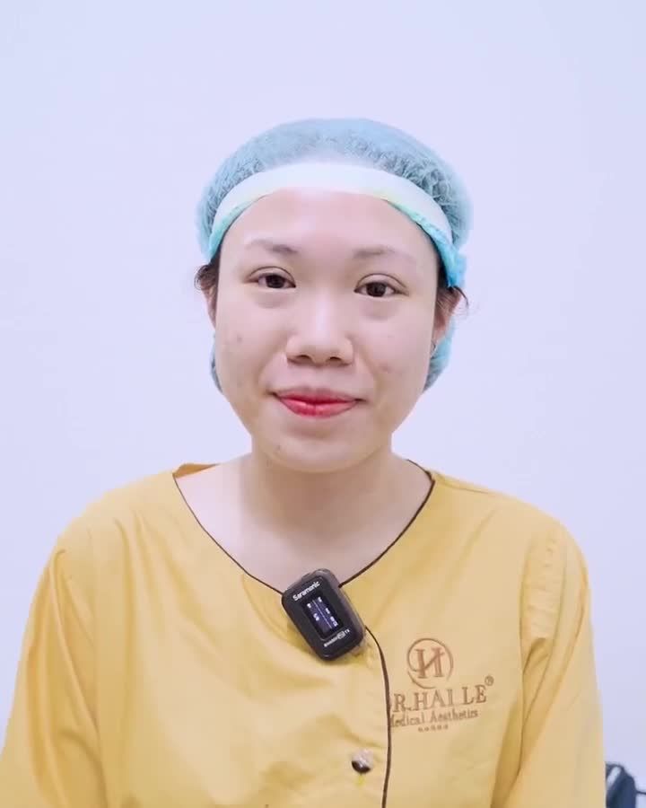 Đây là lý do khách hàng chọn Dr.Hải Lê cắt mí kịp đón Tết