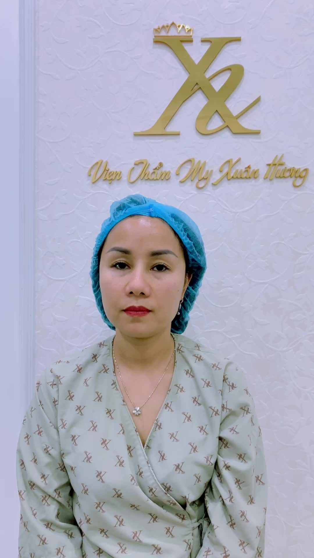 Kết quả độn thái dương sau 4 ngày