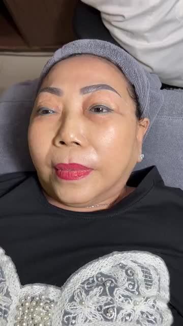 TIÊM COLLAGEN cấp ẩm Quý bà U70 DA KHÔ hóa CĂNG MƯỚT - TRẮNG SÁNG