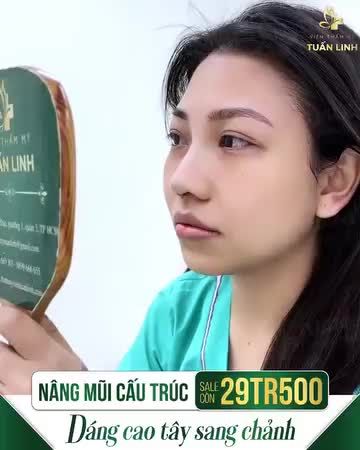 ĐỪNG QUÊN KHUYẾN MÃI - MŨI CẤU TRÚC CÒN 29TR500