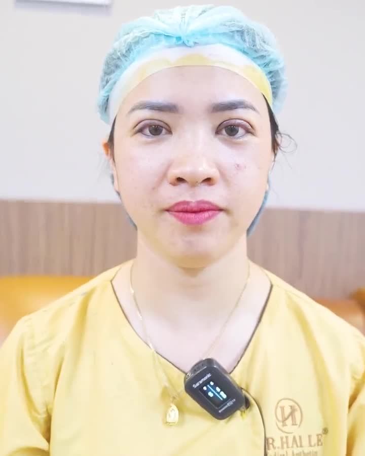 Cắt mí đẹp kịp đón Tết đến ngay Dr.Hải Lê bạn nhé