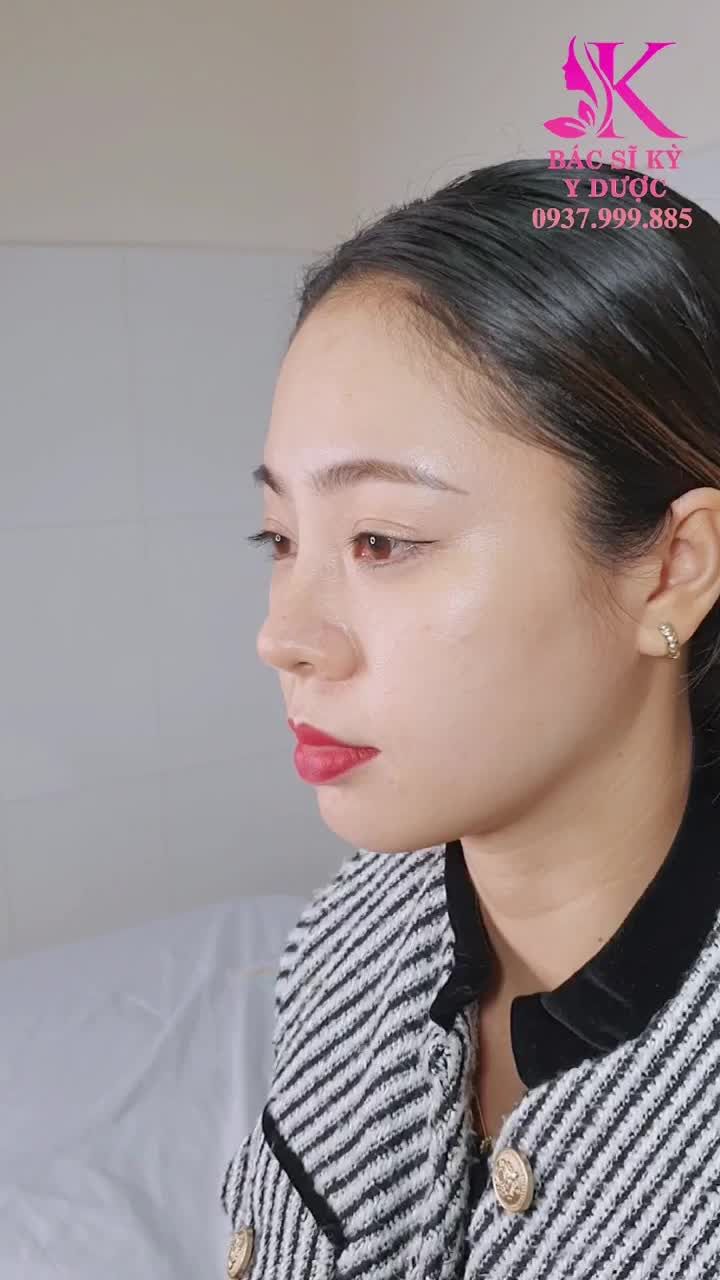 XUÂN KHỞI SẮC CÙNG DÁNG MŨI ALINE