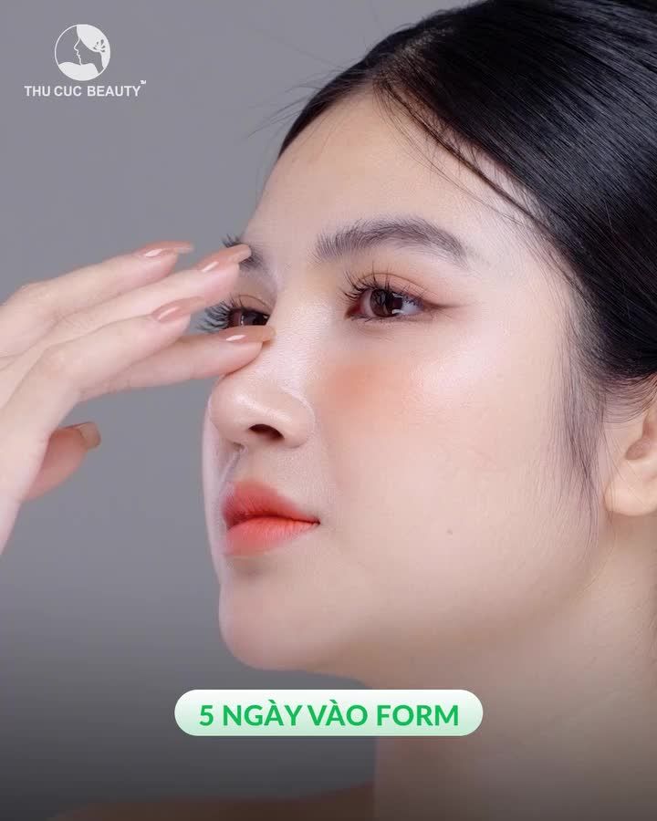 Sống mũi thấp, đầu mũi to đã có thu Cúc lo sau 30P
