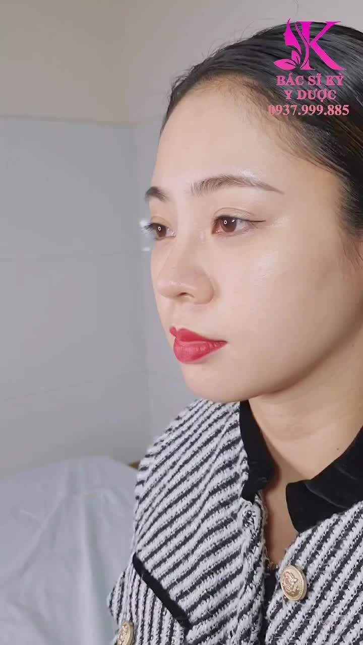 XUÂN KHỞI SẮC CÙNG DÁNG MŨI ALINE