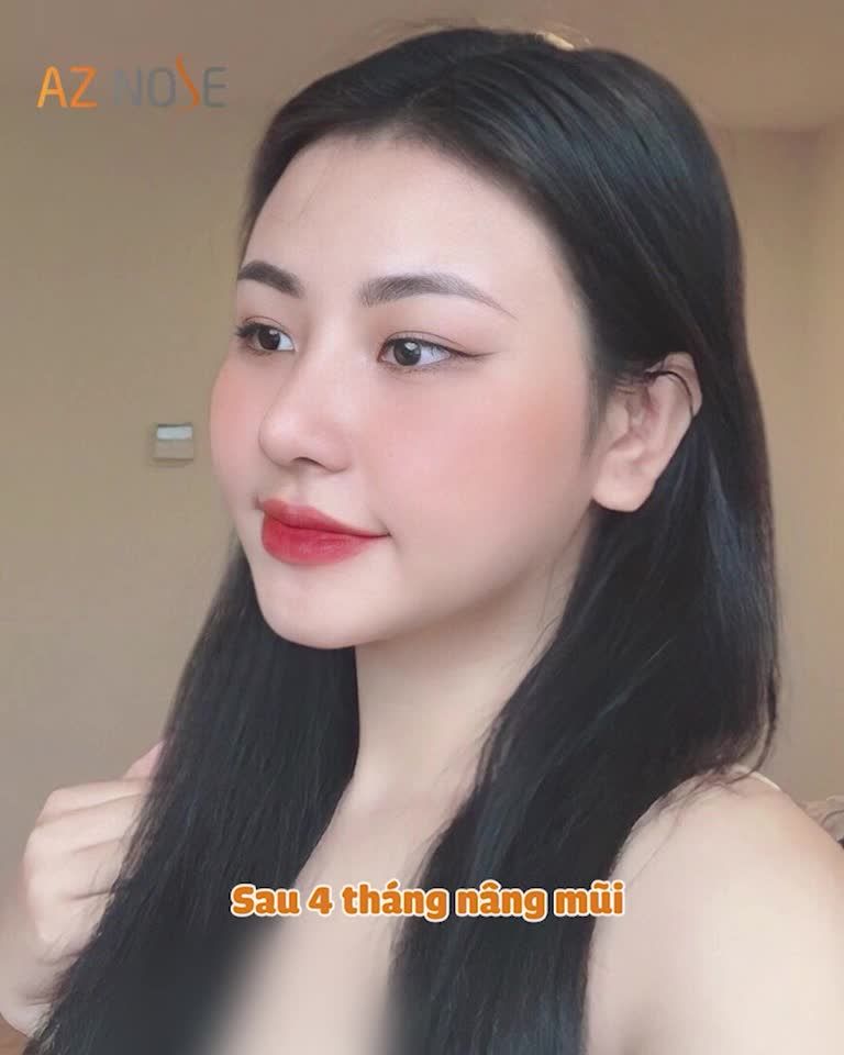 Tự tin mang mũi xinh về Bạc Liêu "ăn tết"