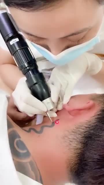 Ở đây nhận mọi ca xóa xăm hình