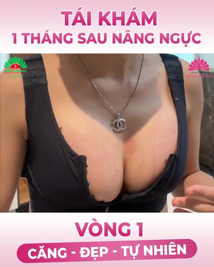 "VÌ ĐẸP MÀ ĐAU CŨNG XỨNG ĐÁNG"