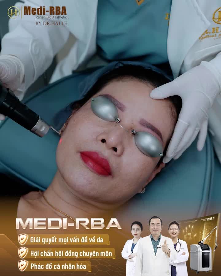 Cùng theo dõi quá trình điều trị phân rã nám cho vị khách hàng của chúng ta qua video dưới đây nhé!