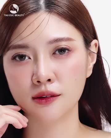 Cắt mí Thu Cúc ngay đón tết
