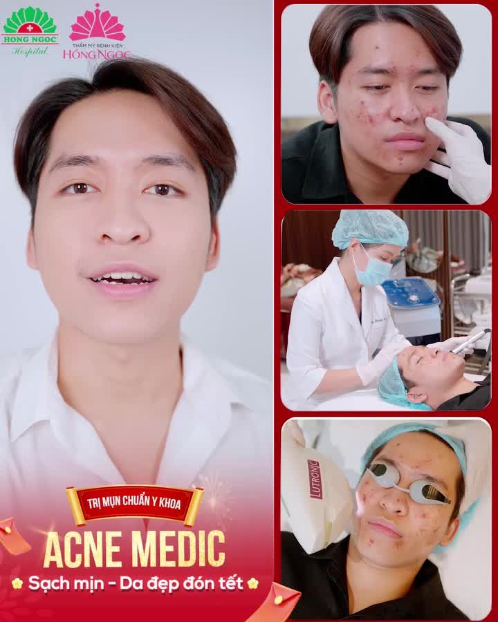MẶT TOÀN MỤN, THÂM LÀM GÌ CŨNG THẤY TỰ TI