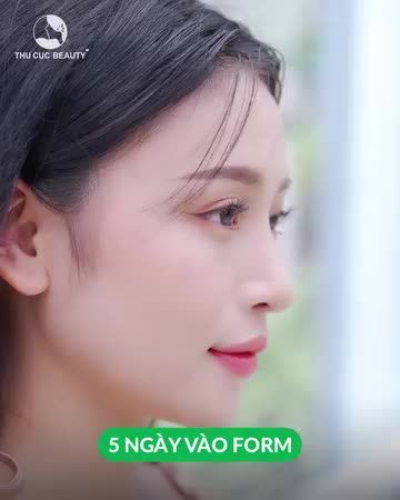 Độ mũi xinh lung linh đón tết