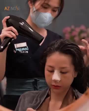 Cần lưu ý những gì khi "gội đầu sau nâng mũi"