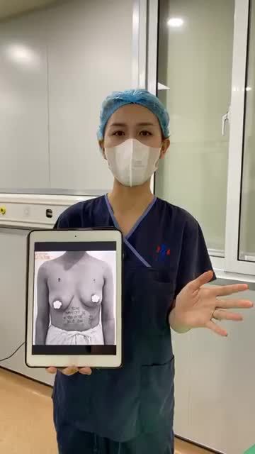 VÒNG 1 LỆCH, XỆ SAU SINH ĐƯỢC EKIP SLINE THAY ĐỔI NHƯ THẾ NÀO???
