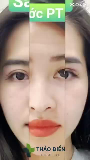 NHẤN MÍ MẮT - giúp thần thái sắc xảo tạo được thiện cảm với người đối diện chỉ với 30 phút !
