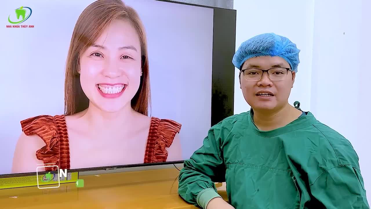 THAY ĐỔI NỤ CƯỜI SAU TIỂU PHẪU CẮT LỢI LÀM DÀI THÂN RĂNG