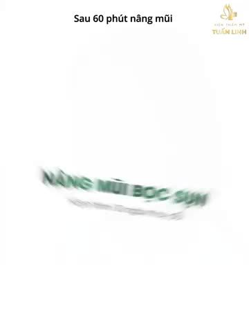 Nâng mũi bọc sụn 15Triệu VÀ Hành trình 10 ngày sở hữu dáng mũi đẹp hoàn hả Click xem ngay để lấy động lực làm đẹp ạ.