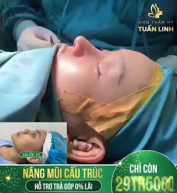 DUY NHẤT ĐỢT NÀY - MŨI CẤU TRÚC SALE CÒN 29TR500
