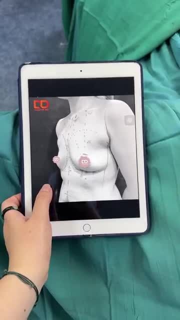 KẾT QUẢ CA TÂN TRANG V1 CHO CHỊ KHÁCH HÀNG ĐÀ NẴNG
