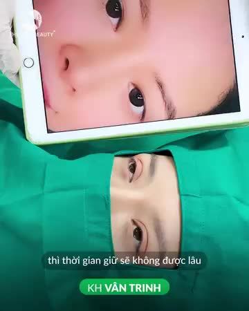 Mắt 2 mí cho khách hàng