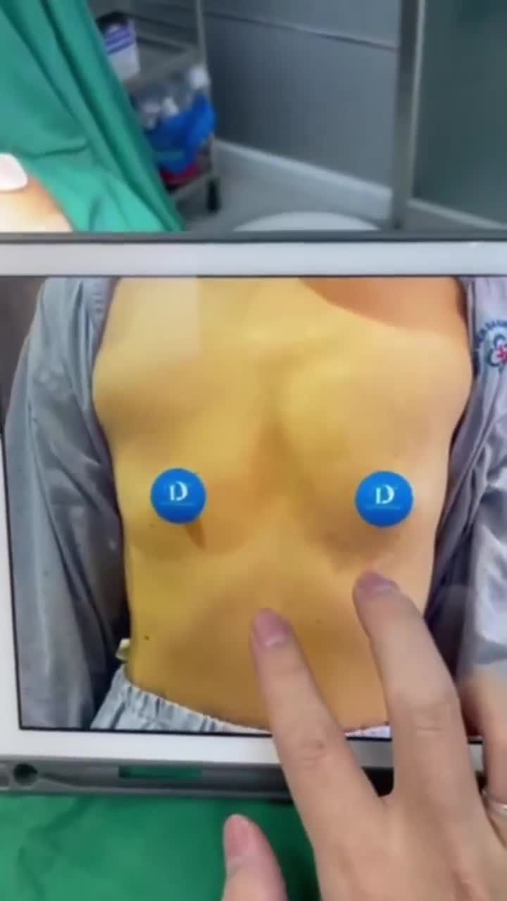 GIẢI PHÁP CHO CẶP LOA LỆCH NHIỀU