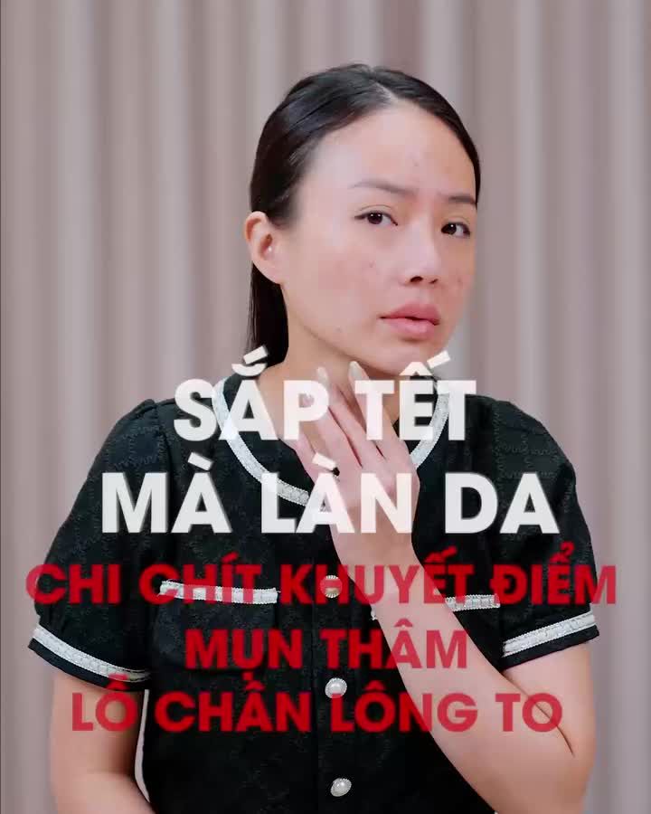 Sắp đến Tết rồi đó, đừng để làn da nhiều khuyết điểm "ngăn cản" bạn đón Tết vui vẻ!