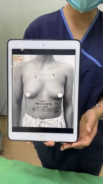 NGẮM VÒNG 1 CỰC SEXY SAU NÂNG CẤP VỚI NANOCHIP EG