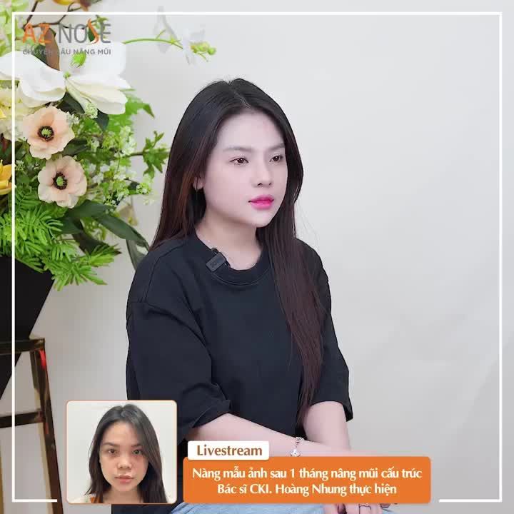 Cảm nhận sau 1 tháng nâng mũi cấu trúc bởi BS CKI. Hoàng Nhung